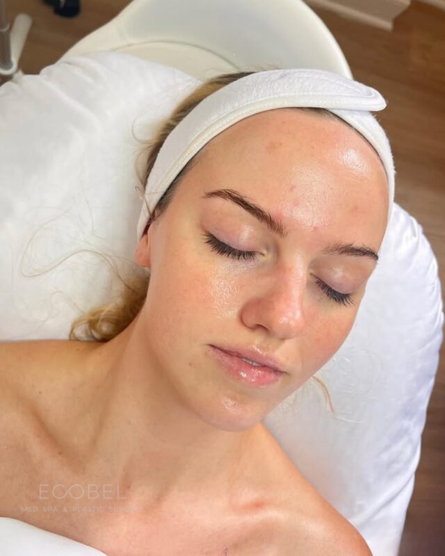 Facials;

Your skin is ready for a summer reset.  
Whether you’re dealing with dullness, breakouts, or just need a deep cleanse, our customized facials meet your skin where it’s at. 

Our signature facial is more than "just a facial." Sculpting, lifting, and plumping the face through face massage is a staple in our signature facials. 

A facial where you can relax AND get results. At Ecobel Med Spa we specialize in results driven, calming treatments. This means that the treatments are designed to provide the results you're looking for.

#AtlantaFacials #BuckheadSkinCare #GlowingSkinATL #AtlantaEsthetician #FacialGoals #CustomFacial #SkinCareAtlanta #MedSpaAtlanta #HealthySkinStartsHere #SkinReset