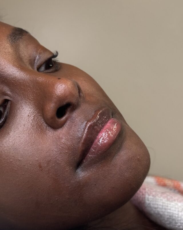 The best lip filler is the kind no one can quite put their finger on.

Soft volume, refined shape and hydration bring your natural lips back to life without looking overdone. 

Every treatment in our space is thoughtfully tailored to your facial features, creating results that feel effortless, balanced and uniquely you. 

Natural is always the goal, book your appointment today.